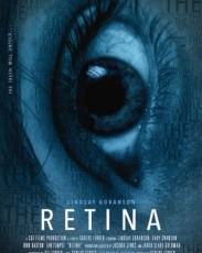 Сетчатка (2017)